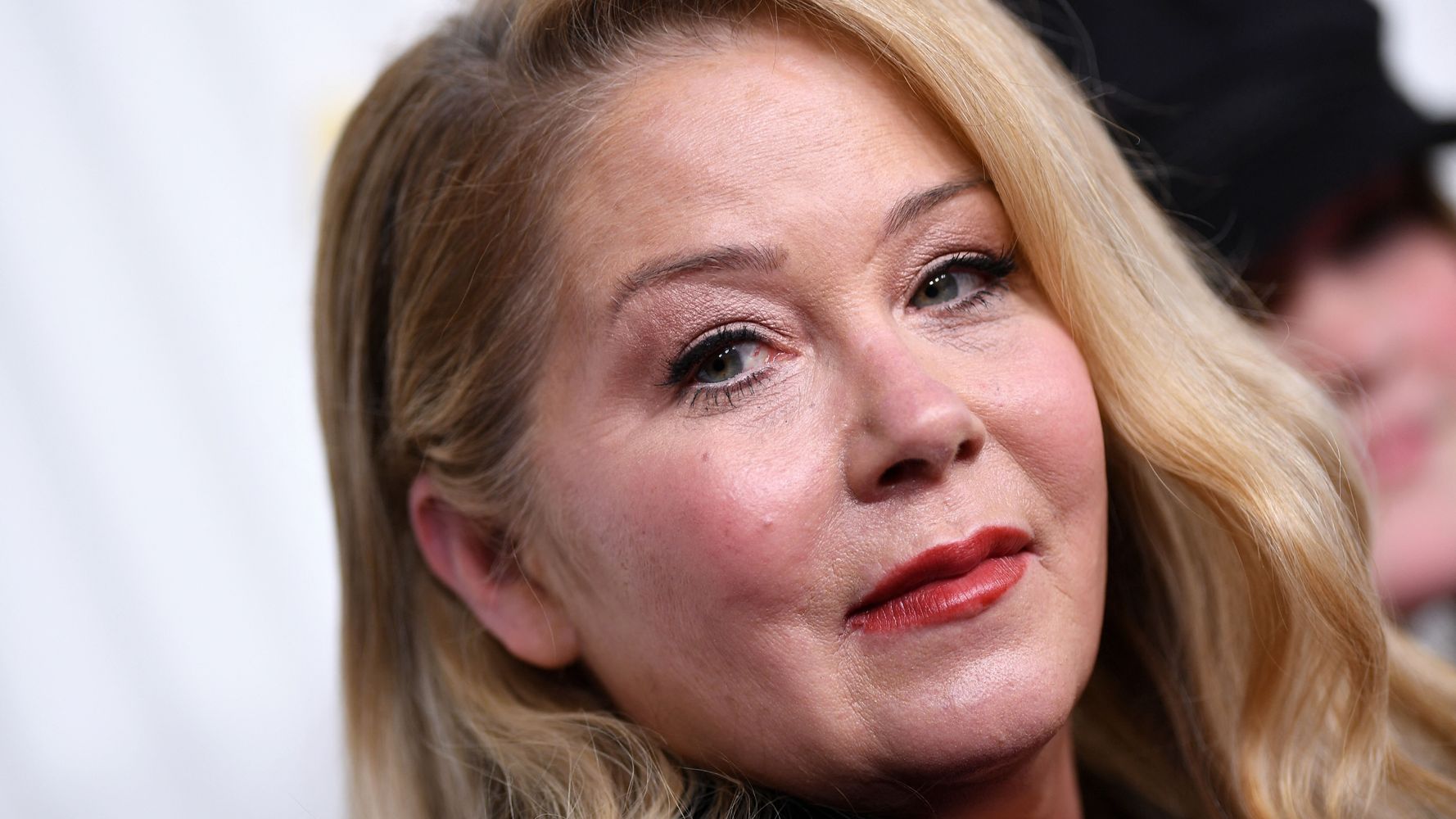 Christina Applegate Reveals ‘The Only Plastic Surgery’ She’s Had, And It’s Heartbreaking